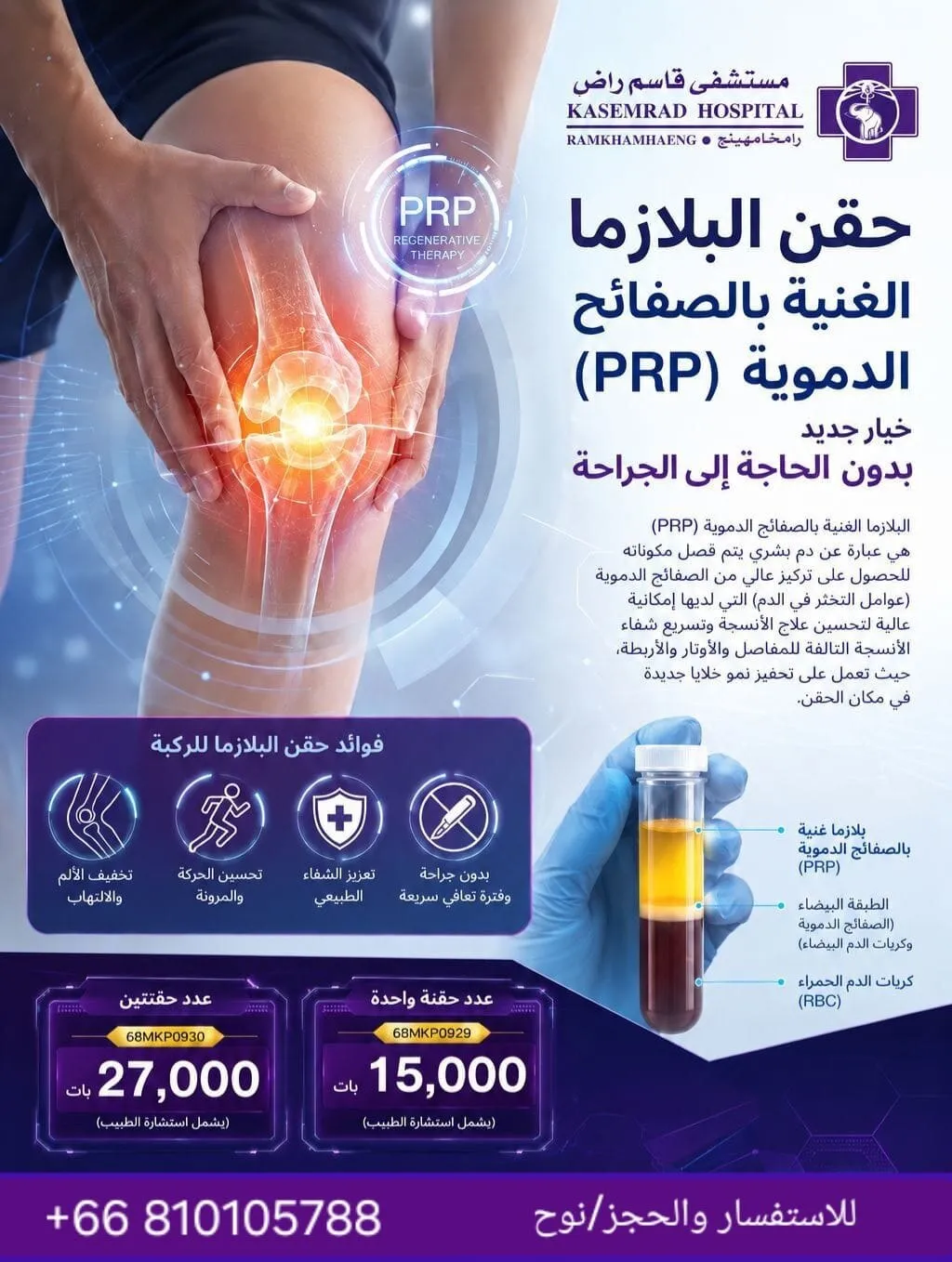 حقن البلازما الغنية بالصفائح الدموية (PRP)